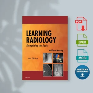 Learning Radiology Recognizing the Basics Williamm Herring Md Facr) [Ebook]